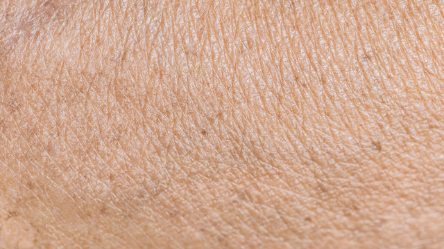 Mature Skin